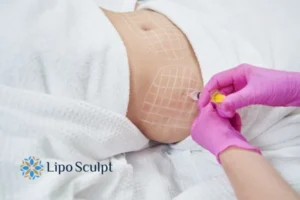 Are The Results From Aqualyx Permanent? 1 Do you want to know how long Aqualyx Chelmsford results last?