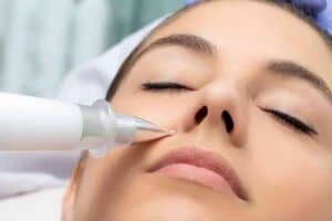 Best Actinic Keratoses Removal 3 Actinic keratoses Chelmsford solutions - book in today!